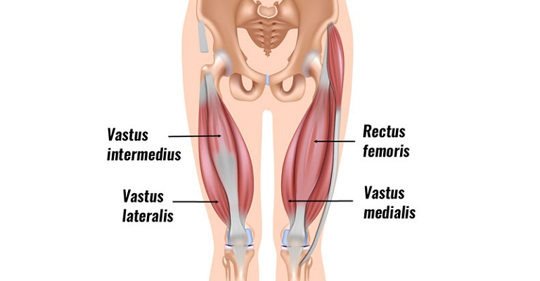 Quadriceps Muscle Strain