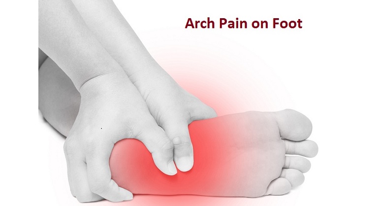 what causes pain in arch of foot