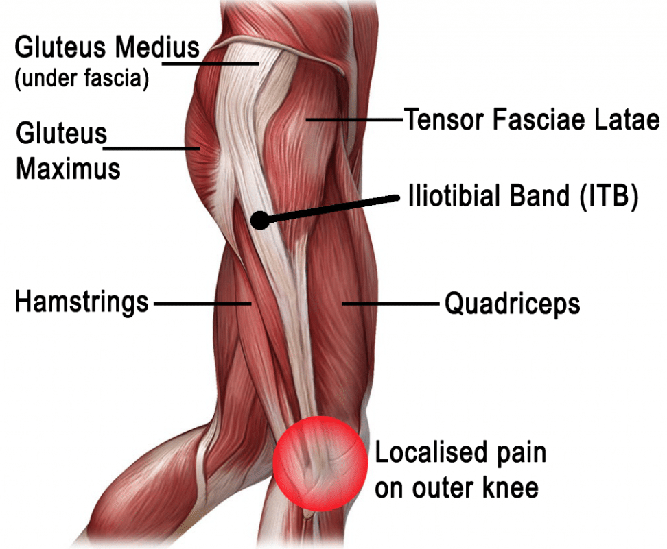 Lateral (Outside) Knee Pain: Causes & Treatment