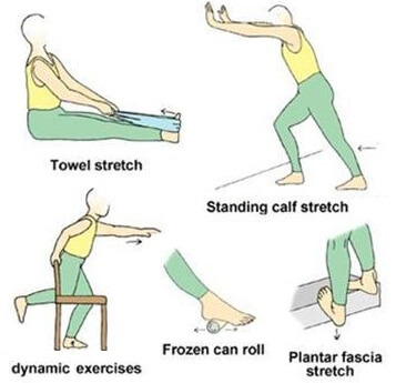 plantar fasciitis stretches