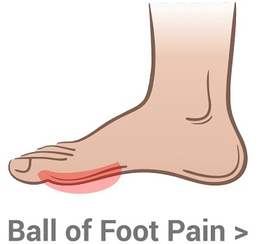 Ball of Foot Pain
