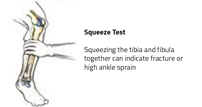 High Ankle Sprain Test