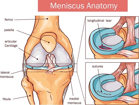 Medial Meniscus Anatomy