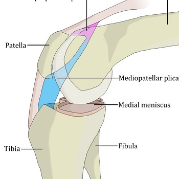 Medial Plica Syndrome