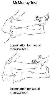 Meniscus Tear Test
