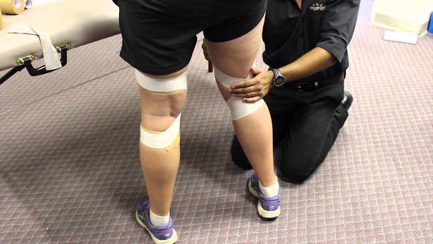 Hyperextended knee Tape