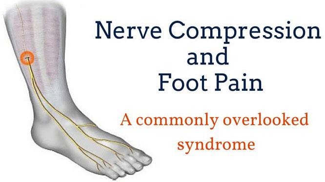 nerve pain on top of foot